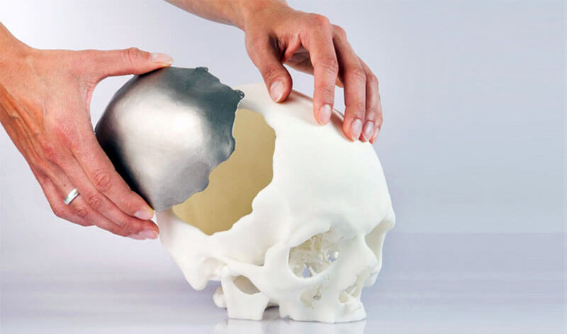 3d-printed-artificial-organs