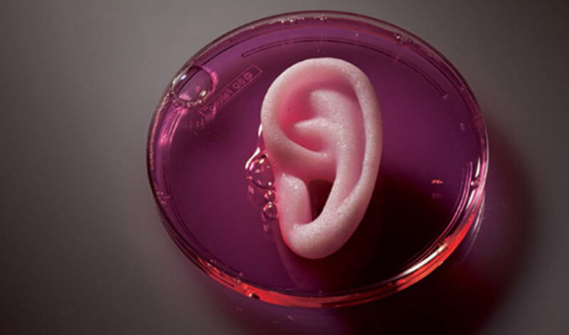 customized-surgical-implants